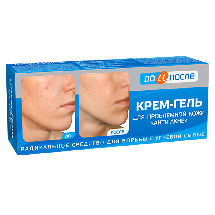 Crema-gel anti-acné pieles con problemas 50 ml
