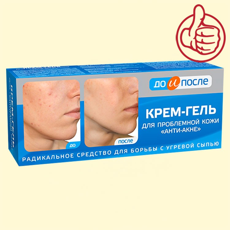 La crema-gel para la piel problematica "el Anti-acne" de 50 ml